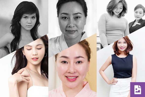 Hình ảnh trước & sau