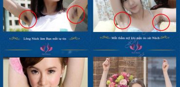 Lông Nách Tổng Hợp