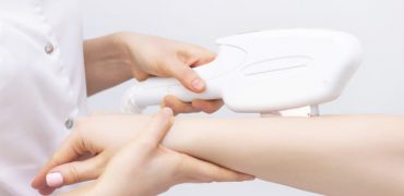 triệt lông tại hana spa