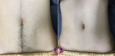 720d12f0ec4f26117f5e