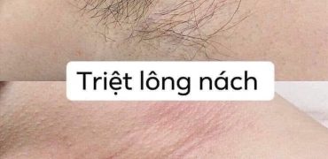 A4817ca42129e077b938