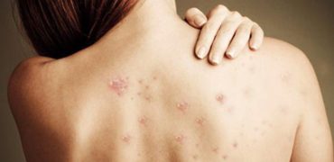 20200109 045916 243767 Mun O Lung.max 1800x1800