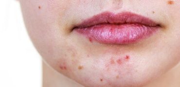 20210609 200312 966907 Nguyen Nhan Mun Xua.max 1800x1800