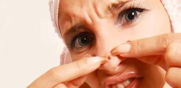 3 Cách Trị Mụn Bọc ở Mũi An Toàn Cho Da 1