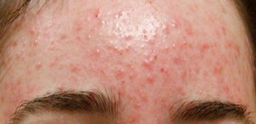 5f68178f12046d74ab26335f 6hvtg11ro0zxeoskt N44qszdrhhwownascs2f T2t Gvcarn47rgpwyxdwnugodqxcq Zrrwvtujawq Mn0eaypjdkimopl3co Covtdc8yjn5l29txwr6jfooih5jbwds76bt5