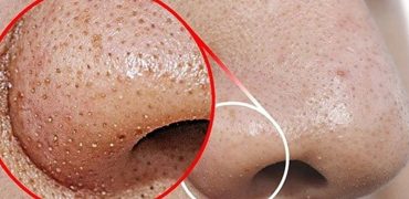 73368fe5 A5c1 4f2e 8