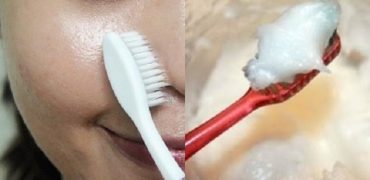 Cach Tri Mun Dau Den Bang Kem Danh Rang 2