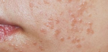 20191127 182853 161154 Mun Coc Phang 3.max 1800x1800