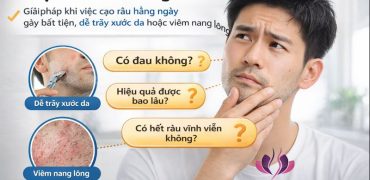 Triệt Râu Cho Nam Giới